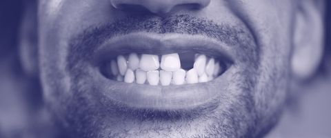 Smile Design - Harvest Dental Care